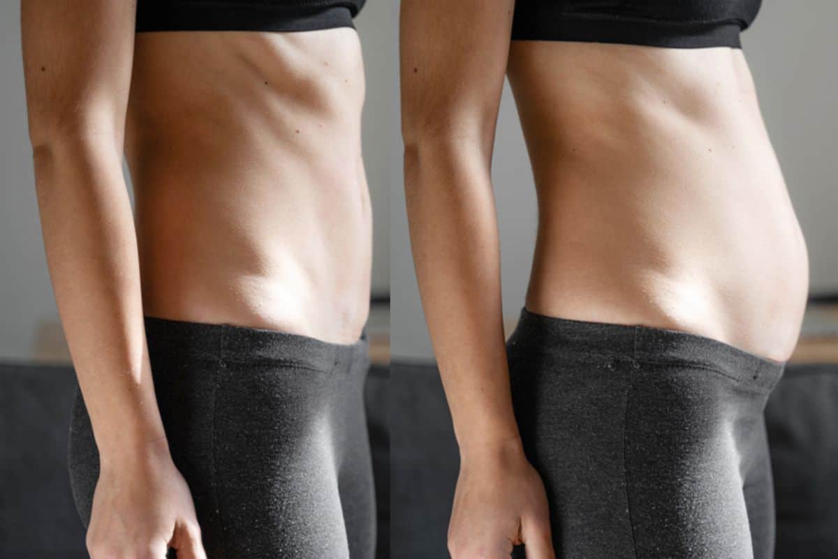 How long does diastasis recti take to improve Herefordshire?