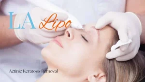Woman receiving Actinic Keratosis Removal Treatment Herefordshire