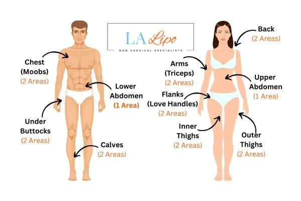 LA LIPO Cryolipolysis Areas Herefordshire