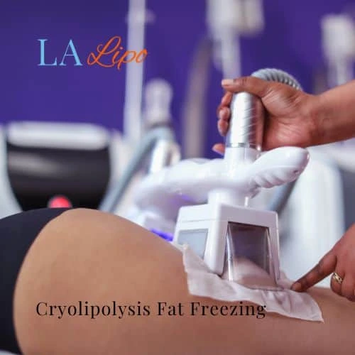 fat freezing - Cryolipolysis Herefordshire