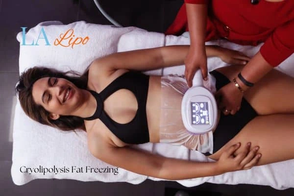 woman getting cryolipolysis Herefordshire