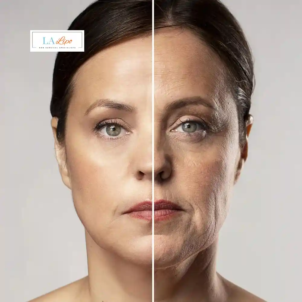 How Can You Tell If Non-Surgical Skin Tightening Is Right for You Herefordshire?