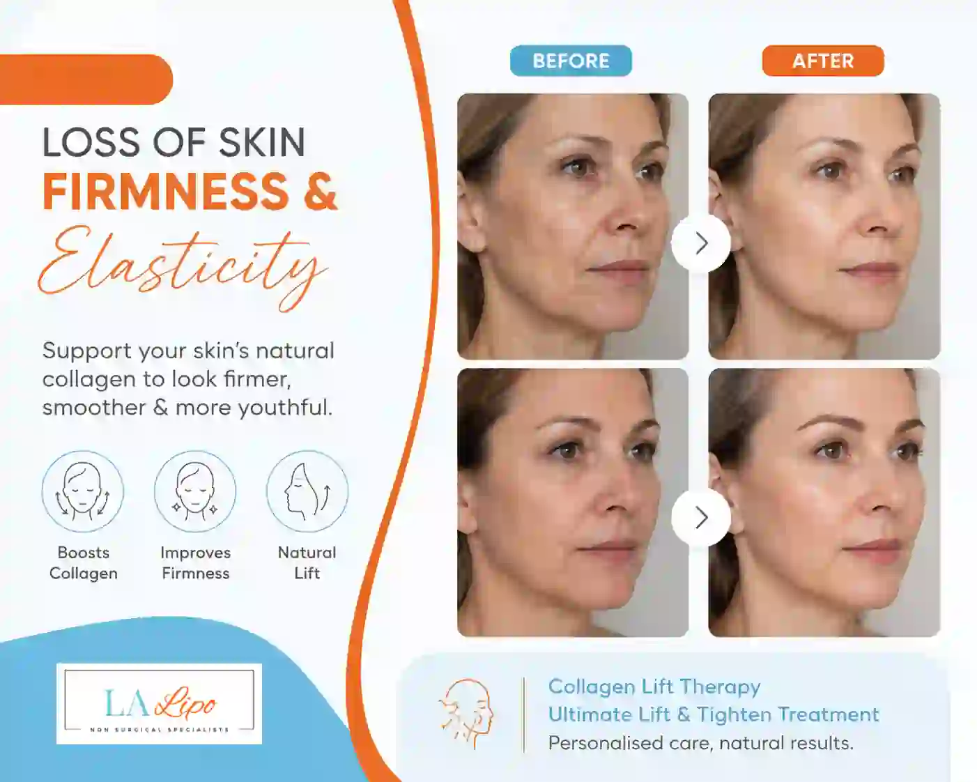 Sign #7: Loss of Skin Firmness and Elasticity Herefordshire