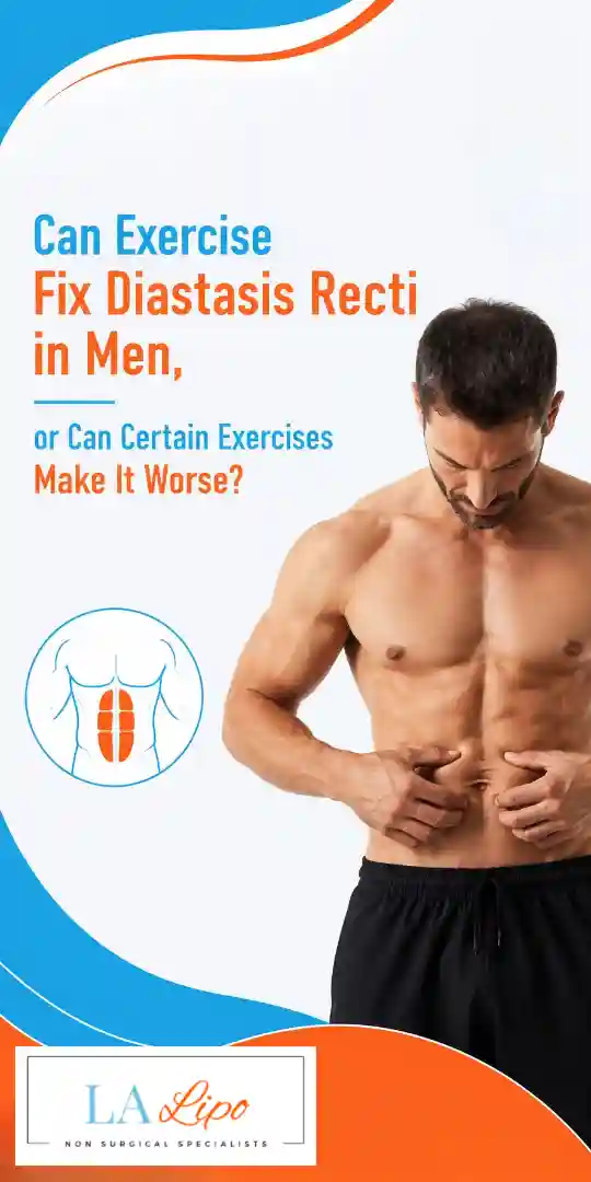 Can Exercise Fix Diastasis Recti in Men, or Can Certain Exercises Make It Worse Herefordshire?
